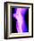 X-Ray of a Knee-null-Framed Photographic Print