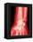 X-ray of a Wrist-null-Framed Premier Image Canvas