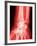 X-ray of a Wrist-null-Framed Photographic Print