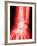 X-ray of a Wrist-null-Framed Photographic Print