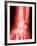 X-ray of a Wrist-null-Framed Photographic Print