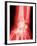 X-ray of a Wrist-null-Framed Photographic Print