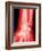 X-ray of a Wrist-null-Framed Photographic Print