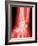 X-ray of a Wrist-null-Framed Photographic Print