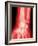 X-ray of a Wrist-null-Framed Photographic Print