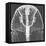 X-ray of an Egyptian Mask-Science Source-Framed Premier Image Canvas