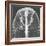 X-ray of an Egyptian Mask-Science Source-Framed Giclee Print