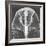 X-ray of an Egyptian Mask-Science Source-Framed Giclee Print