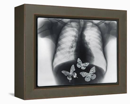 X-ray of butterflies in the stomach-Thom Lang-Framed Premier Image Canvas