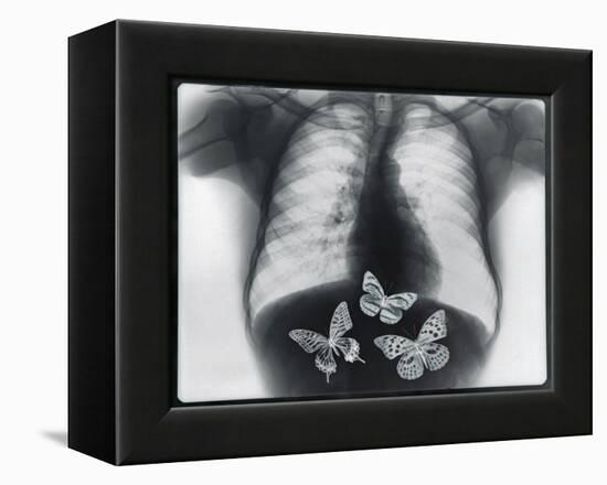 X-ray of butterflies in the stomach-Thom Lang-Framed Premier Image Canvas