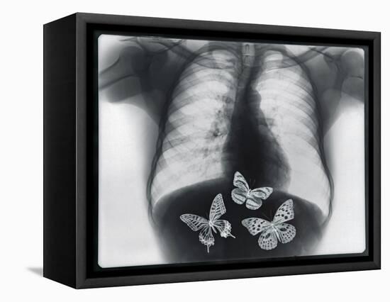 X-ray of butterflies in the stomach-Thom Lang-Framed Premier Image Canvas