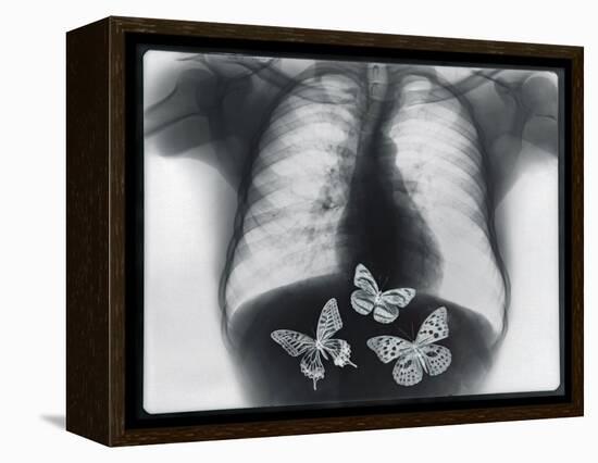 X-ray of butterflies in the stomach-Thom Lang-Framed Premier Image Canvas