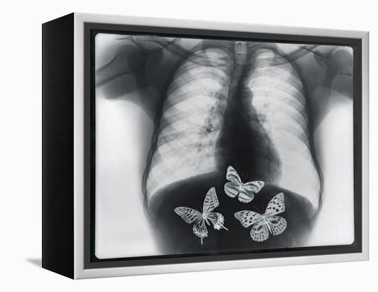 X-ray of butterflies in the stomach-Thom Lang-Framed Premier Image Canvas