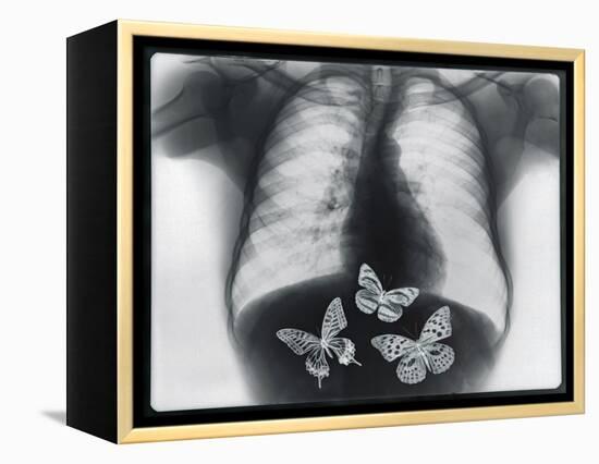X-ray of butterflies in the stomach-Thom Lang-Framed Premier Image Canvas