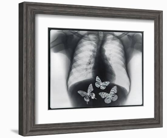 X-ray of butterflies in the stomach-Thom Lang-Framed Photographic Print