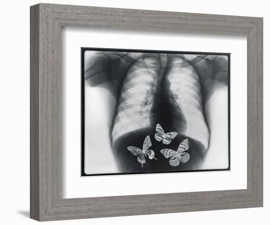 X-ray of butterflies in the stomach-Thom Lang-Framed Photographic Print