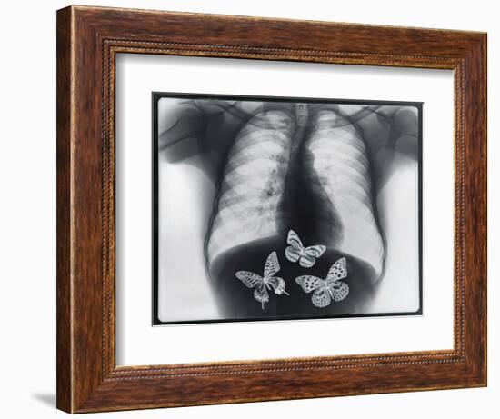 X-ray of butterflies in the stomach-Thom Lang-Framed Photographic Print