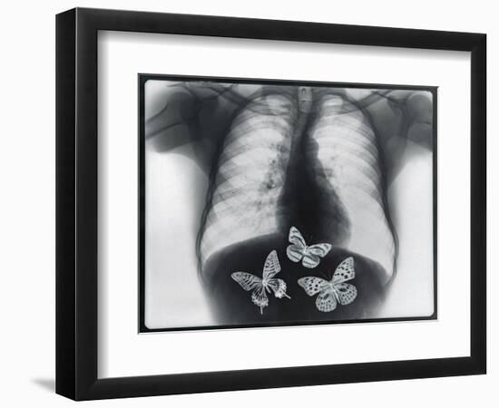 X-ray of butterflies in the stomach-Thom Lang-Framed Photographic Print