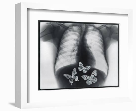 X-ray of butterflies in the stomach-Thom Lang-Framed Photographic Print