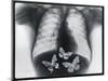 X-ray of butterflies in the stomach-Thom Lang-Mounted Photographic Print