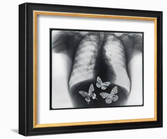 X-ray of butterflies in the stomach-Thom Lang-Framed Photographic Print