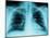 X-Ray of Dark Lungs-Robert Llewellyn-Mounted Photographic Print