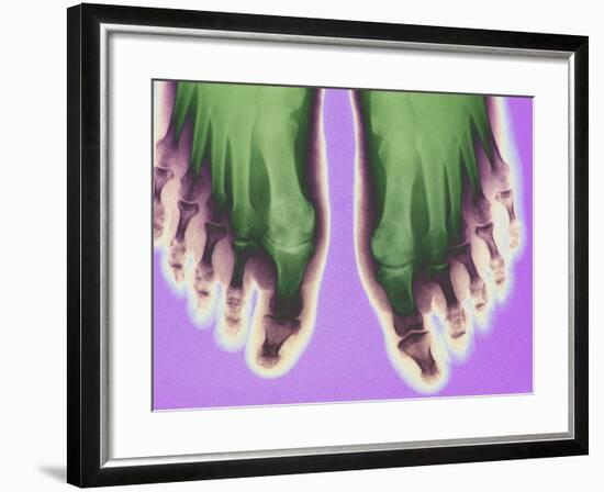 X-ray of Feet-null-Framed Premium Photographic Print