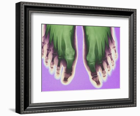 X-ray of Feet-null-Framed Photographic Print