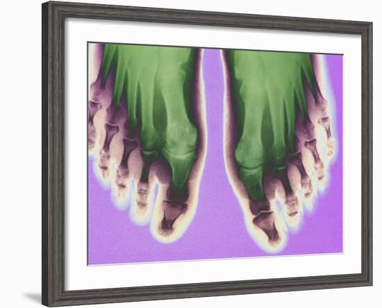 X-ray of Feet-null-Framed Photographic Print