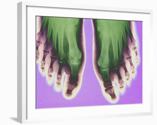 X-ray of Feet-null-Framed Photographic Print