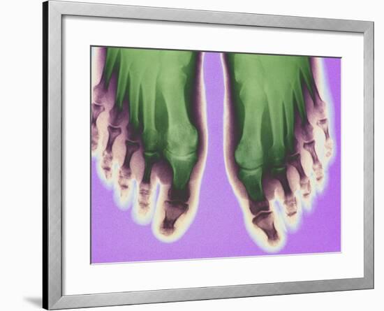 X-ray of Feet-null-Framed Photographic Print