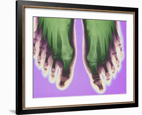 X-ray of Feet-null-Framed Photographic Print