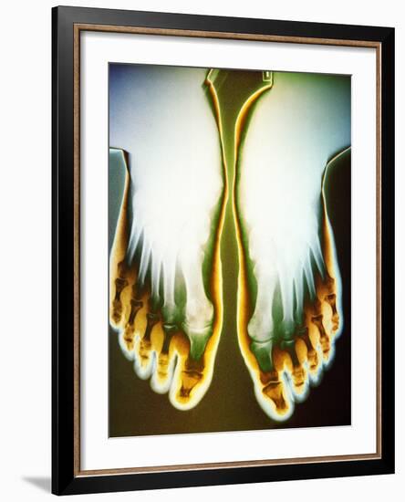 X-ray of Feet-null-Framed Photographic Print