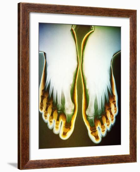 X-ray of Feet-null-Framed Photographic Print