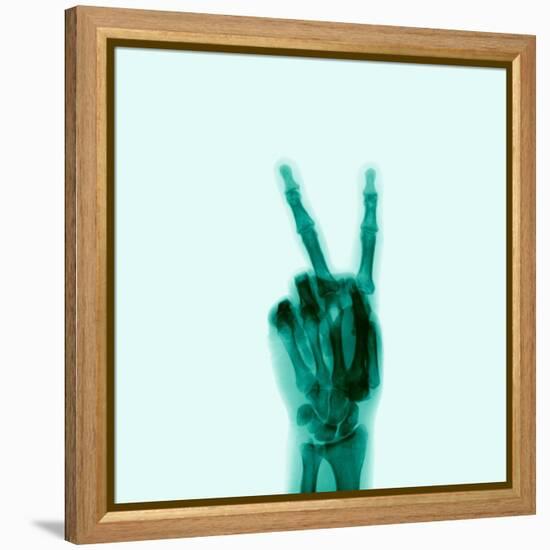 X-Ray of Hand Doing Peace Sign-null-Framed Premier Image Canvas