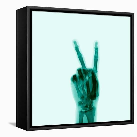 X-Ray of Hand Doing Peace Sign-null-Framed Premier Image Canvas