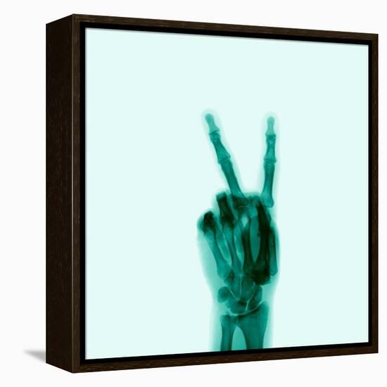 X-Ray of Hand Doing Peace Sign-null-Framed Premier Image Canvas