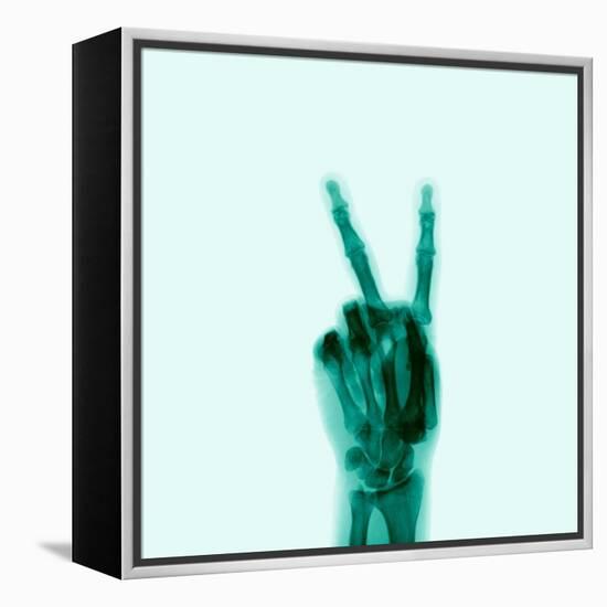 X-Ray of Hand Doing Peace Sign-null-Framed Premier Image Canvas