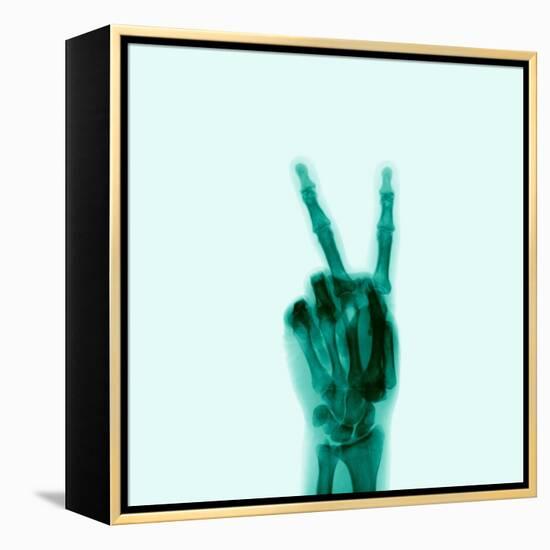 X-Ray of Hand Doing Peace Sign-null-Framed Premier Image Canvas