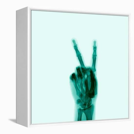 X-Ray of Hand Doing Peace Sign-null-Framed Premier Image Canvas