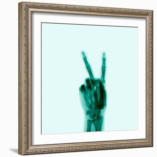 X-Ray of Hand Doing Peace Sign-null-Framed Photographic Print