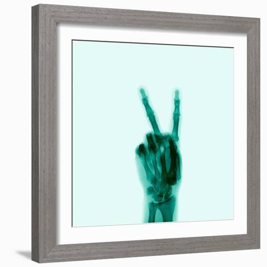 X-Ray of Hand Doing Peace Sign--Framed Photographic Print