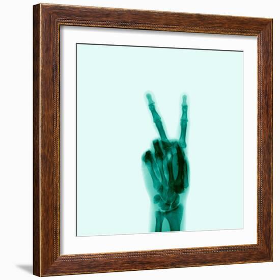 X-Ray of Hand Doing Peace Sign-null-Framed Photographic Print