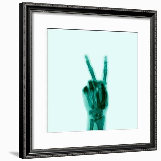 X-Ray of Hand Doing Peace Sign-null-Framed Photographic Print