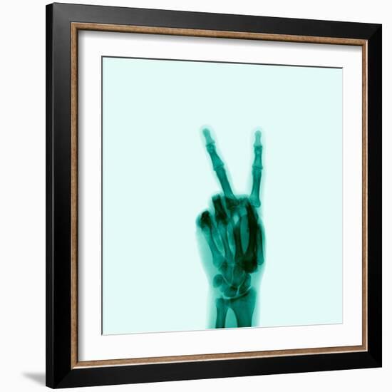 X-Ray of Hand Doing Peace Sign-null-Framed Photographic Print