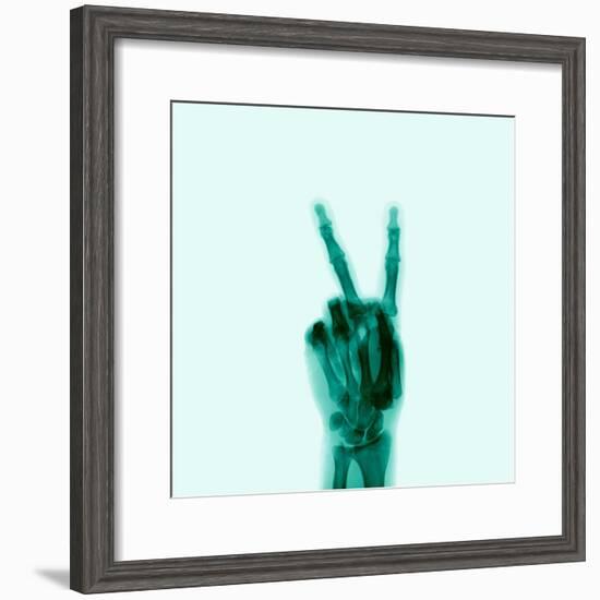 X-Ray of Hand Doing Peace Sign-null-Framed Photographic Print