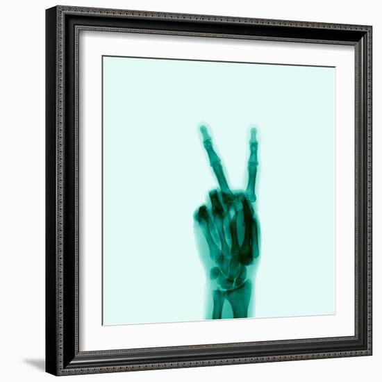 X-Ray of Hand Doing Peace Sign-null-Framed Photographic Print