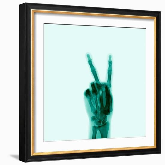 X-Ray of Hand Doing Peace Sign-null-Framed Photographic Print