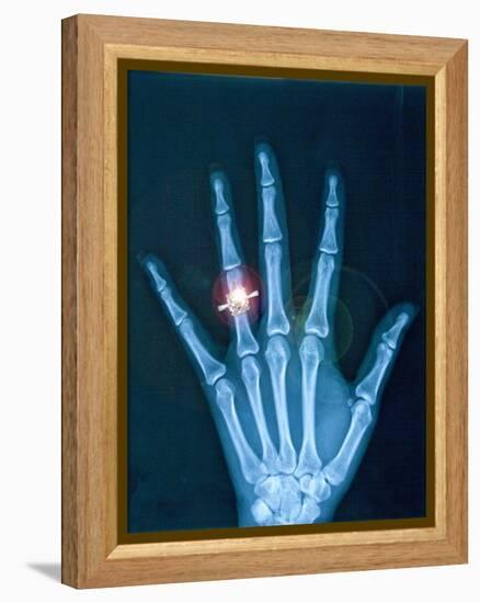 X-ray of hand with diamond ring-Thom Lang-Framed Premier Image Canvas