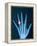 X-ray of hand with diamond ring-Thom Lang-Framed Premier Image Canvas